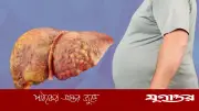 ওজন না কমার পেছনে লিভারের গোপন রোগ ফ্যাটি লিভার