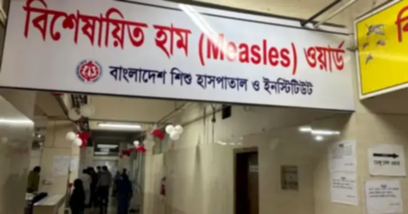 ২৪ ঘণ্টায় হামে আরও ৫ শিশুর মৃত্যু, আক্রান্ত ১১০৭
