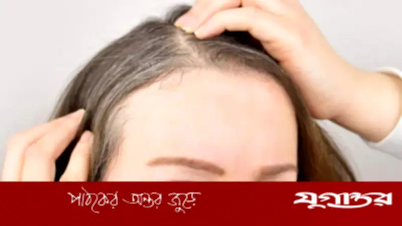 ৩০-এর আগেই চুলে পাক? অকালপক্বতা রুখতে ব্যবহার করুন এই ৫ তেলের মিশ্রণ