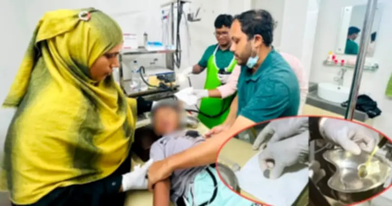 ফরিদপুরে ৭ বছরের শিশুর পাকস্থলী থেকে এন্ডোস্কোপিতে কয়েন অপসারণ