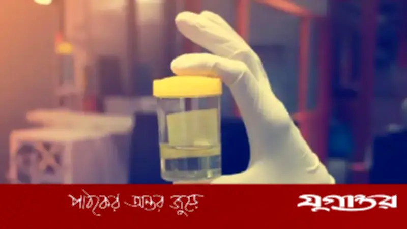 প্রস্রাবের রঙ কি সব রোগের ইঙ্গিত দেয়? চিকিৎসকের মতামত