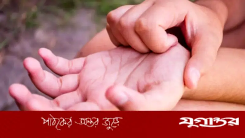 হাতের তালু চুলকানো রোগের ইঙ্গিত হতে পারে, জানুন কারণ
