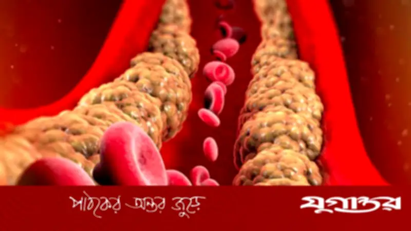 কোলেস্টেরল সামান্য বেশি হলে কী করবেন? বিশেষজ্ঞদের পরামর্শ