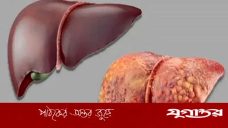 ৪০-এর আগেই লিভার নষ্ট করতে পারে এই ৩ অভ্যাস