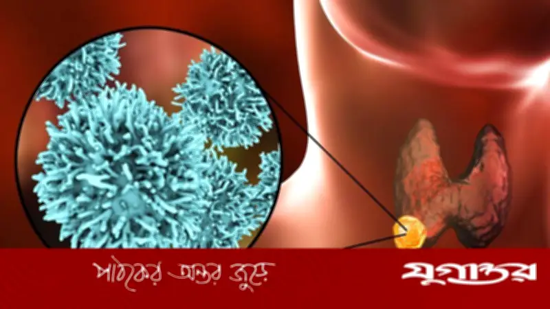 গলার ক্যানসারের লক্ষণ: কখন সতর্ক হবেন জেনে নিন