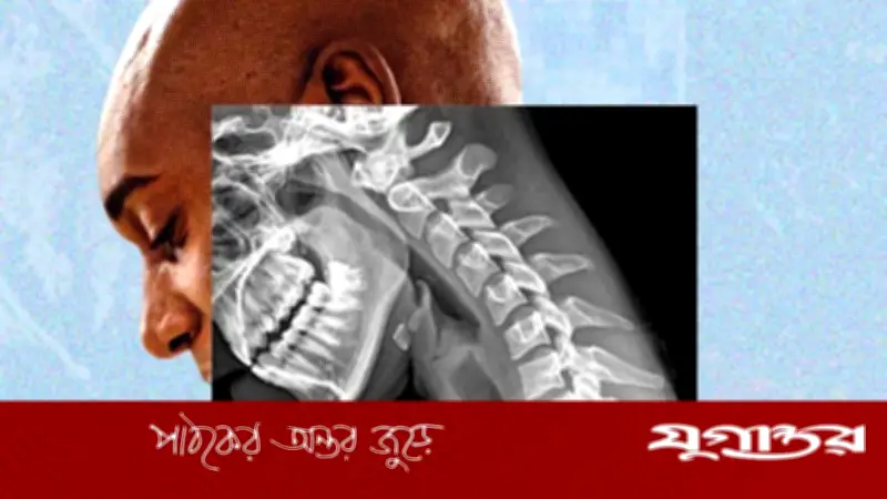 প্রযুক্তির কারণে ‘ফোন বডি’র শিকার: দুর্বল হাত, ঝাপসা দৃষ্টি