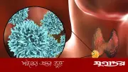 গলার ক্যানসারের লক্ষণ: কখন সতর্ক হবেন জেনে নিন