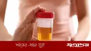 প্রস্রাবের রঙ জানিয়ে দেবে আপনি কোন মারাত্মক রোগে ভুগছেন